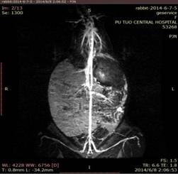135 冠状位效果.jpg